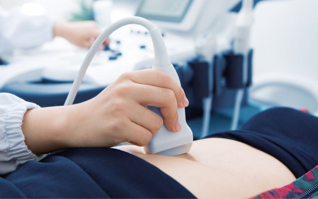 nurse performing ultrasound on woman
